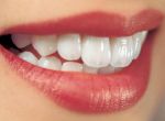 6 phương pháp tự nhiên giúp răng trắng